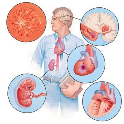 Persoană care practică tehnica palming pentru relaxarea ochilor